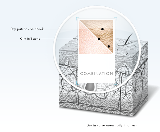 Combination Skin Combination Skin