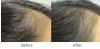 Professional Hair Growth Program