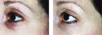 Teamine eye complex sales