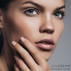 JUVÉDERM® Ultra Plus XC