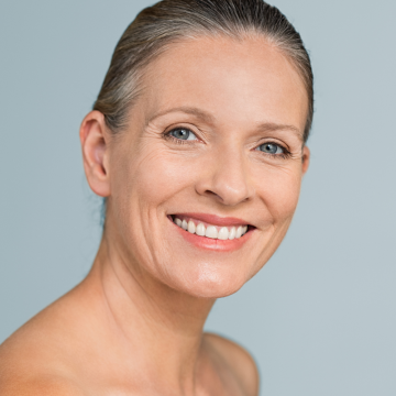 BBL® Broadband Light Laser Treatment