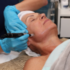 Collagen Induction Therapy