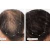 NUTRAFOL® for Men