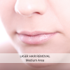 Laser Hair Removal - Medium Area