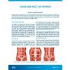 EMSCULPT®