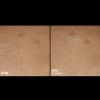 Skinbetter Science® Trio Rebalancing Moisture Treatment™ FACE Before & After