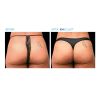 EMSCULPT®