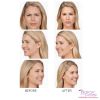 Botox B&A