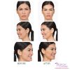 Botox B&A