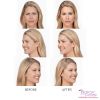  BOTOX® by the Unit (min 20cc)