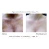 before and after 2