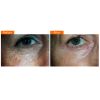 Youth EssentiA® Range Vita-Peptide Eye Gel Before & After