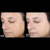 SkinBetter Even Tone Correcting Serum Before & After