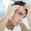 Consultation for Hair Loss/Hair Restoration