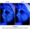 Halo Before and After Two UV