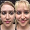 Microblading
