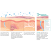 Silagen 100% Pure Silicone Gel