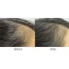 Professional Hair Growth Program