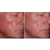 Face - Before & After