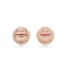 JUVÉDERM® Ultra Plus XC Consultation