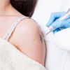 Tattoo Removal
