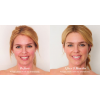 bendBEAUTY Anti-Aging Formula
