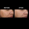 SkinMedica Lytera® 2.0 Before and After Two
