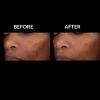 SkinMedica Lytera® 2.0 Before and After Four
