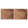 Revision Skincare Nectifirm® ADVANCED Before and After