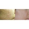 For Revive Medical Spa only. DO NOT REUSE.