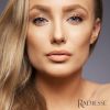 Radiesse Lidocaine