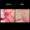 Silagen 100% Pure Silicone Gel