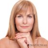 SkinCeuticals® Advanced Corrective Peel