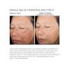 SkinMedica Rejuvenize Peel before and after