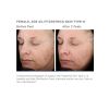 SkinMedica Vitalize Peel B&A