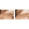 Teamine Eye Complex Before & After3