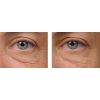 Teamine Eye Complex Before & After2