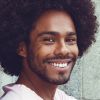 Medium Depth Chemical Peel For Men NCDA only