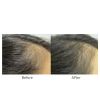 Viviscal® Advanced Hair Health Professional Strength - 180 Tablets