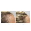 Viviscal® Advanced Hair Health Professional Strength - 180 Tablets
