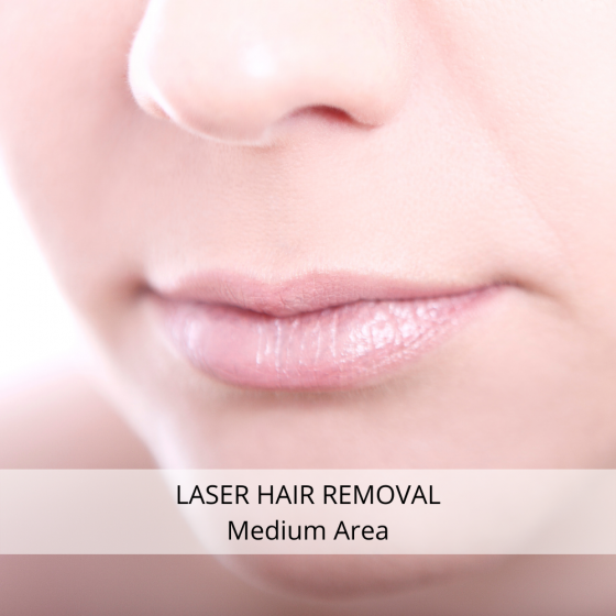 Laser Hair Removal - Medium Area
