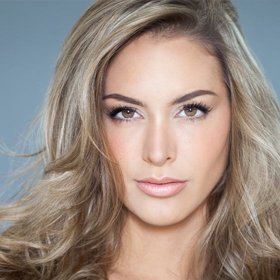 Chin Augmentation with Filler