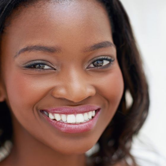 Microneedling with PRP