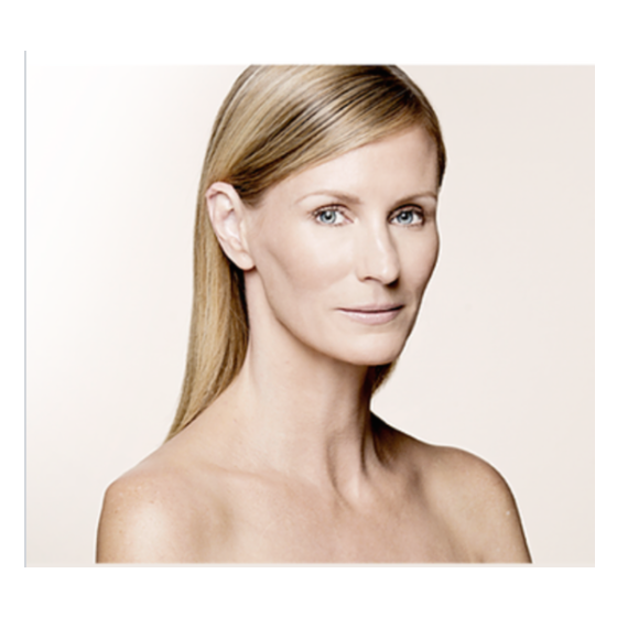 Vivace™ Micro-Needling with PRP
