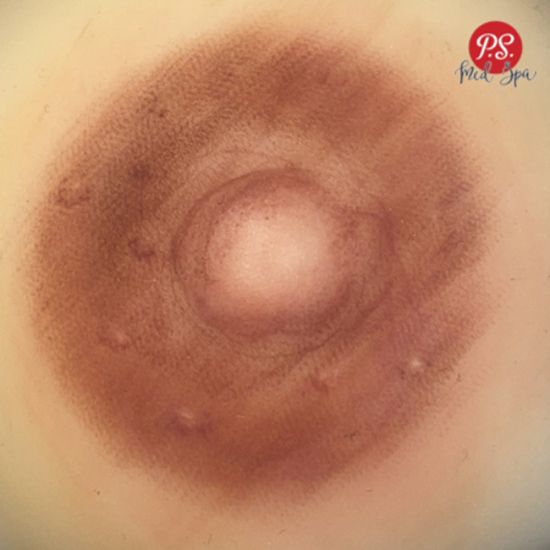 3D Areola Tattoo
