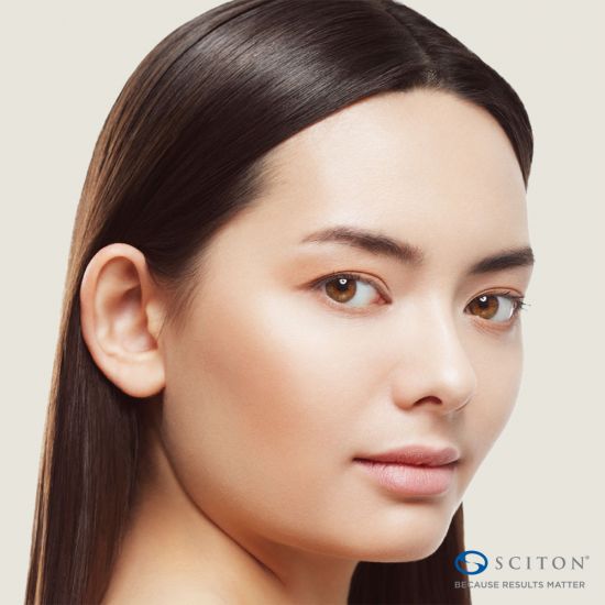 NanoLaserPeel™
