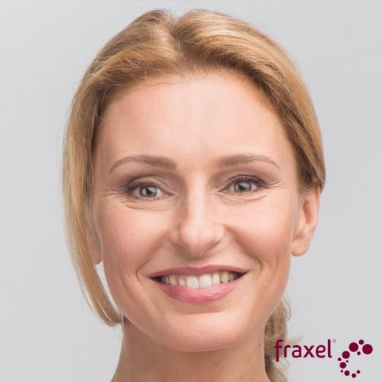 Fraxel Restore Laser Resurfacing - 12 options