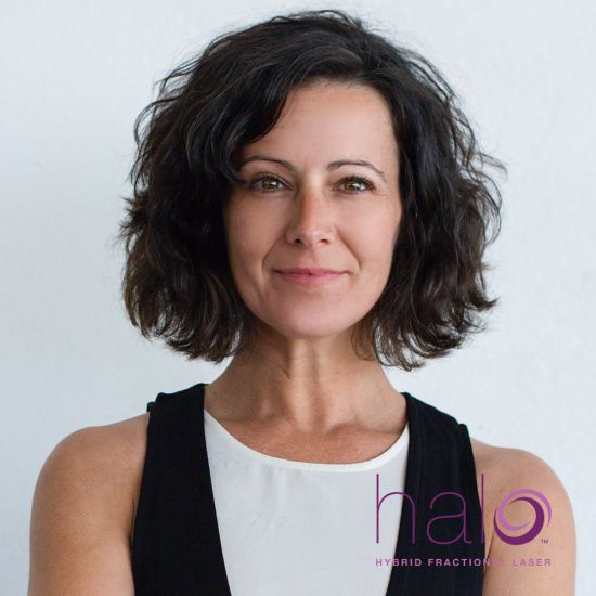 Halo™ MINI Hybrid Fractional Laser - Single Options 