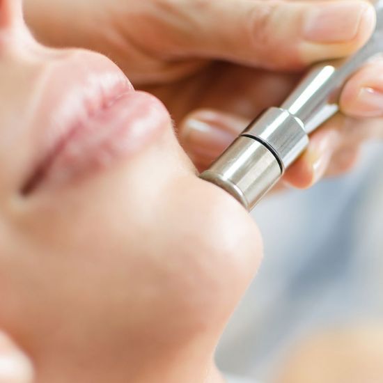 Microdermabrasion