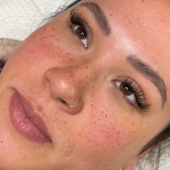 Beauty Marks & Faux Freckles - Permanent Makeup